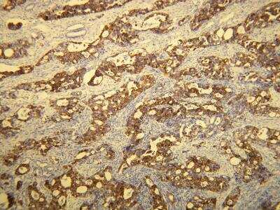 Immunohistochemistry-Paraffin: Cytokeratin 20 Antibody (E19-I) [NBP2-21840]