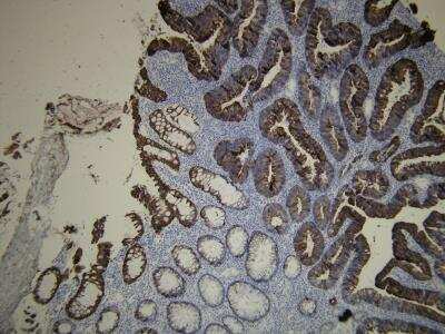 Immunohistochemistry-Paraffin: Cytokeratin 20 Antibody (E19-I) [NBP2-21840]