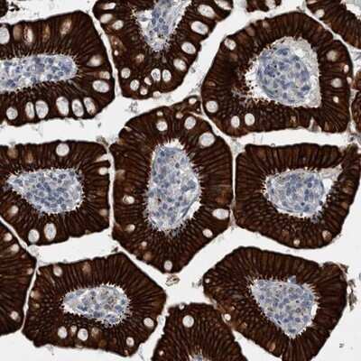 Immunohistochemistry-Paraffin: Cytokeratin 20 Antibody [NBP1-85600]