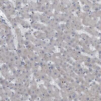 Immunohistochemistry-Paraffin: Cytokeratin 20 Antibody [NBP1-85600]