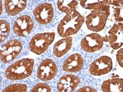 Immunohistochemistry-Paraffin: Cytokeratin 20 Antibody (KRT20/1991) [NBP3-07285]