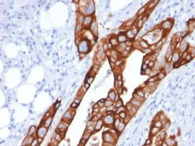 Immunohistochemistry-Paraffin: Cytokeratin 20 Antibody (KRT20/1991) - Azide and BSA Free [NBP3-08406]