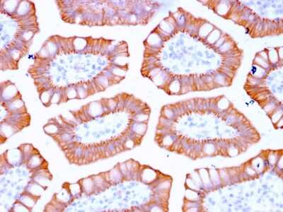 Immunohistochemistry-Paraffin: Cytokeratin 20 Antibody (KRT20/3129R) - Azide and BSA Free [NBP3-08636]