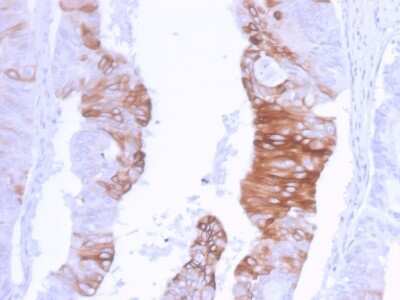 Immunohistochemistry-Paraffin: Cytokeratin 20 Antibody (KRT20/3129R) [NBP3-07634]