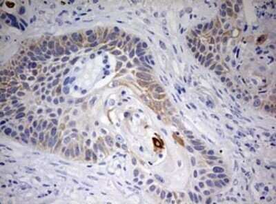 Immunohistochemistry: Cytokeratin 20 Antibody (OTI3G1) - Azide and BSA Free [NBP2-71962]