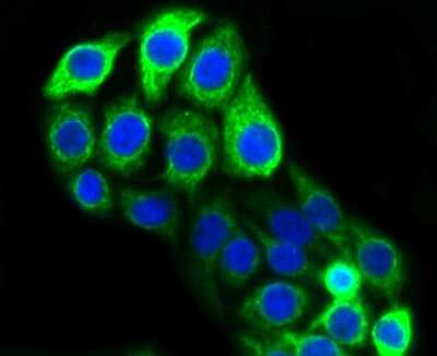 Immunocytochemistry/ Immunofluorescence: Cytokeratin 20 Antibody (SA35-03) [NBP2-67309]