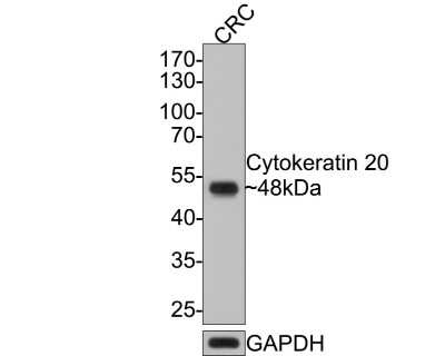 Western Blot: Cytokeratin 20 Antibody (SA35-03) [NBP2-67309]