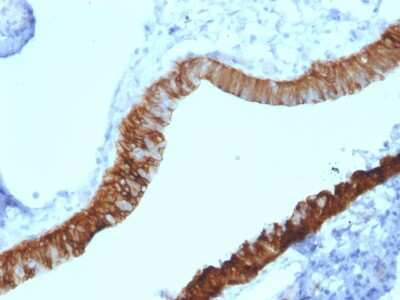 Immunohistochemistry-Paraffin: Cytokeratin 3 Antibody (KRT3/2130) [NBP2-79718]