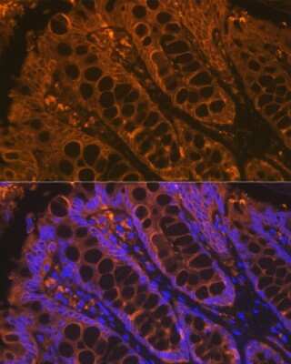 Immunohistochemistry: Cytokeratin 4 Antibody (6H9R6) [NBP3-15243]