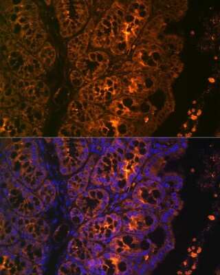 Immunohistochemistry: Cytokeratin 4 Antibody (6H9R6) [NBP3-15243]