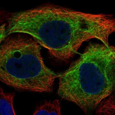Immunocytochemistry/ Immunofluorescence: Cytokeratin 4 Antibody [NBP2-33984]