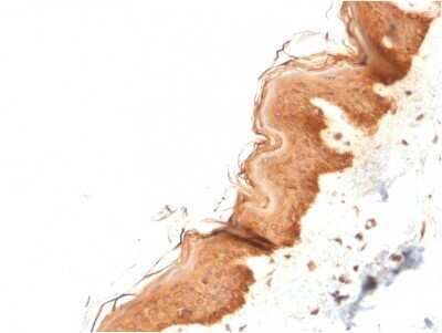 Immunohistochemistry-Paraffin: Cytokeratin 4 Antibody (KRT4/2804) [NBP3-07797]