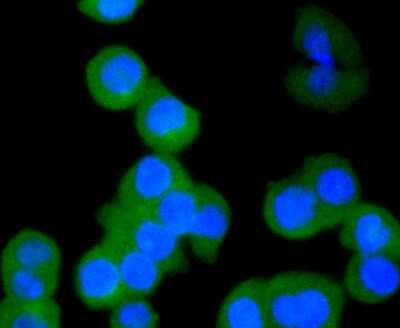 Immunocytochemistry/ Immunofluorescence: Cytokeratin 4 Antibody (SN74-03) [NBP2-67706]
