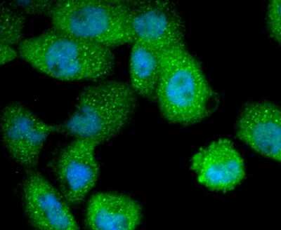 Immunocytochemistry/ Immunofluorescence: Cytokeratin 4 Antibody (SN74-03) [NBP2-67706]