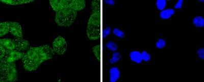 Immunocytochemistry/ Immunofluorescence: Cytokeratin 4 Antibody (SN74-03) [NBP2-67706]
