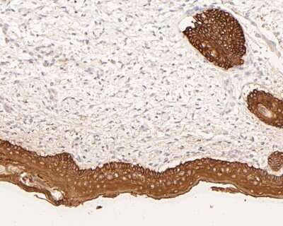 Immunohistochemistry-Paraffin: Cytokeratin 5/6 Antibody (A2A12) [NBP2-80401]