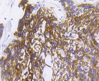 Immunohistochemistry-Paraffin: Cytokeratin 5/75 Antibody (SC62-04) [NBP2-67586]