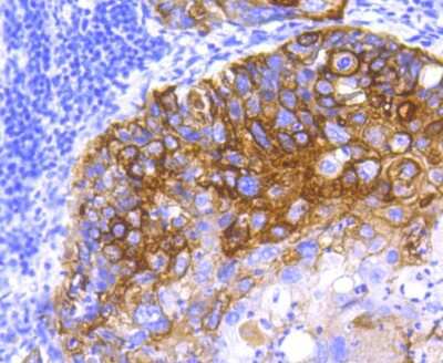 Immunohistochemistry-Paraffin: Cytokeratin 5/75 Antibody (SC62-04) [NBP2-67586]