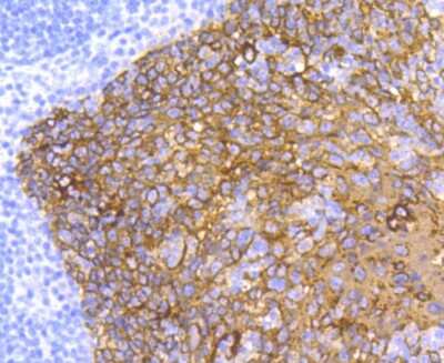 Immunohistochemistry-Paraffin: Cytokeratin 5/75 Antibody (SC62-04) [NBP2-67586]