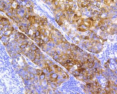 Immunohistochemistry-Paraffin: Cytokeratin 5/75 Antibody (SC62-04) [NBP2-67586]