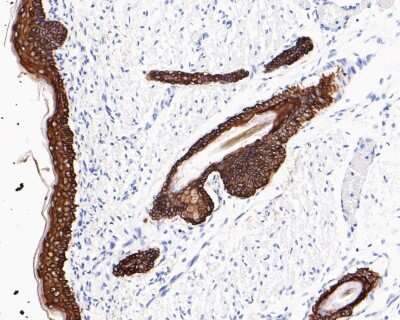 Immunohistochemistry-Paraffin: Cytokeratin 5/75 Antibody (SC62-04) [NBP2-67586]