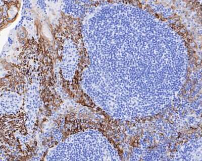Immunohistochemistry-Paraffin: Cytokeratin 5/75 Antibody (SC62-04) [NBP2-67586]