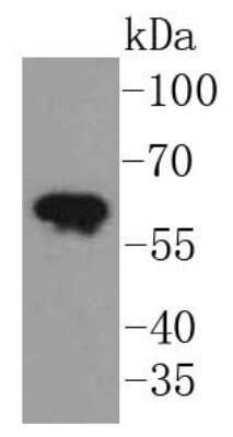 Western Blot: Cytokeratin 5/75 Antibody (SC62-04) [NBP2-67586]