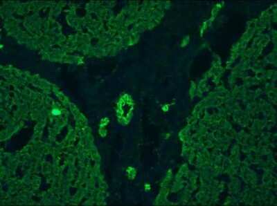 Immunohistochemistry-Frozen: Cytokeratin 5/8 Antibody (RCK102) - BSA Free [NBP1-97730]