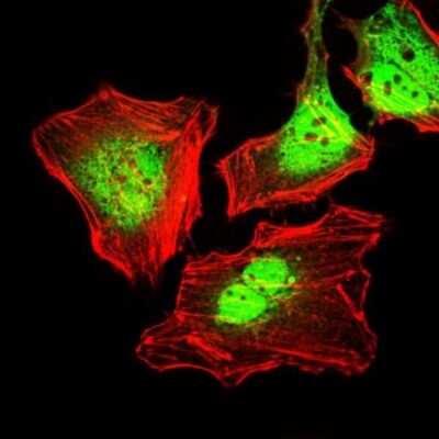 Immunocytochemistry/ Immunofluorescence: Cytokeratin 5 Antibody (2C2) - BSA Free [NBP2-22194]