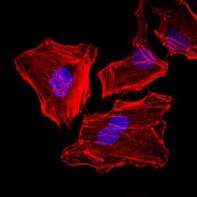 Immunocytochemistry/ Immunofluorescence: Cytokeratin 5 Antibody (2C2) - BSA Free [NBP2-22194]
