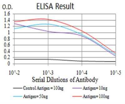 ELISA: Cytokeratin 5 Antibody (2C8E4) - BSA Free [NBP2-52443]