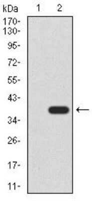 Western Blot: Cytokeratin 5 Antibody (2C8E4)BSA Free [NBP2-52443]