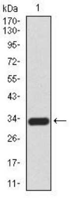 Western Blot: Cytokeratin 5 Antibody (3D6D4)BSA Free [NBP2-52444]