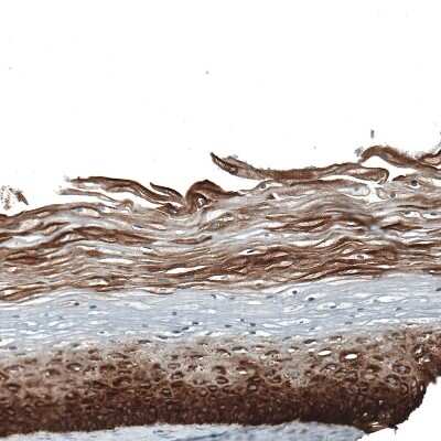 Immunohistochemistry-Paraffin: Cytokeratin 5 Antibody (CL9297) [NBP2-88923]