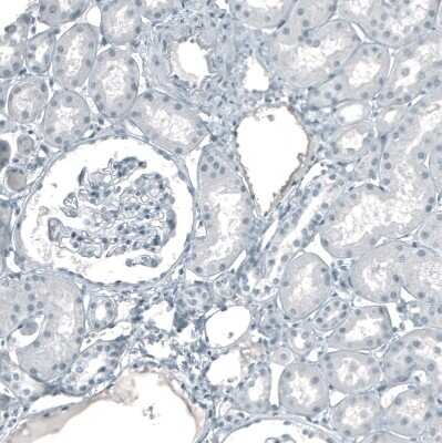 Immunohistochemistry-Paraffin: Cytokeratin 5 Antibody (CL9297) [NBP2-88923]