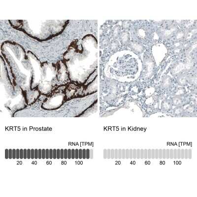 Immunohistochemistry-Paraffin: Cytokeratin 5 Antibody (CL9297) [NBP2-88923]
