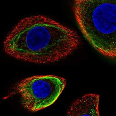 Immunocytochemistry/ Immunofluorescence: Cytokeratin 5 Antibody [NBP2-32470]