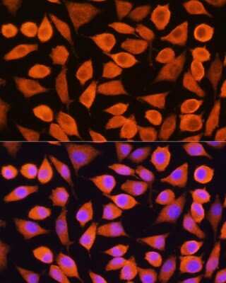 Immunocytochemistry/ Immunofluorescence: Cytokeratin 5 Antibody - Azide and BSA Free [NBP2-92884]