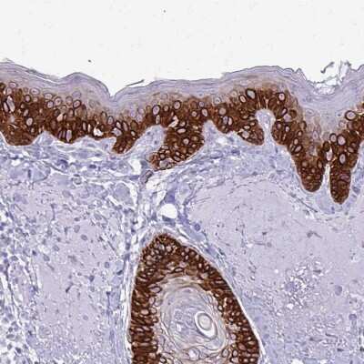 Immunohistochemistry-Paraffin: Cytokeratin 5 Antibody [NBP2-32470]