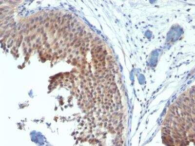 Immunohistochemistry-Paraffin: Cytokeratin 6 Antibody (SPM269) [NBP2-34358]