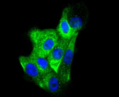 Immunocytochemistry/ Immunofluorescence: Cytokeratin 6a Antibody (SN71-07) [NBP2-67705]