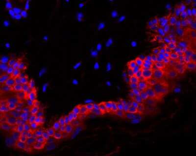 Immunohistochemistry-Paraffin: Cytokeratin 6a Antibody (SN71-07) [NBP2-67705]
