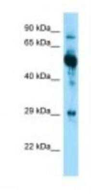 Western Blot: Cytokeratin 6a Antibody [NBP1-98557]