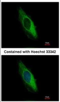 Immunocytochemistry/ Immunofluorescence: Cytokeratin 6b Antibody [NBP2-14924]