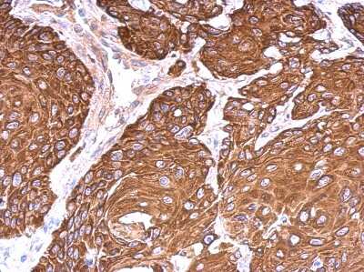 Immunohistochemistry-Paraffin: Cytokeratin 6b Antibody [NBP2-14924]