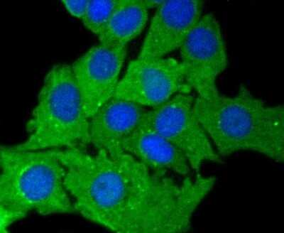 Immunocytochemistry/ Immunofluorescence: Cytokeratin 7/13/17/18 Antibody (ST50-05) [NBP2-67533]