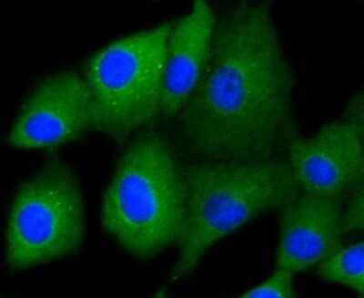 Immunocytochemistry/ Immunofluorescence: Cytokeratin 7/13/17/18 Antibody (ST50-05) [NBP2-67533]