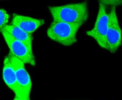 Immunocytochemistry/ Immunofluorescence: Cytokeratin 7/13/17/18 Antibody (ST50-05) [NBP2-67533]