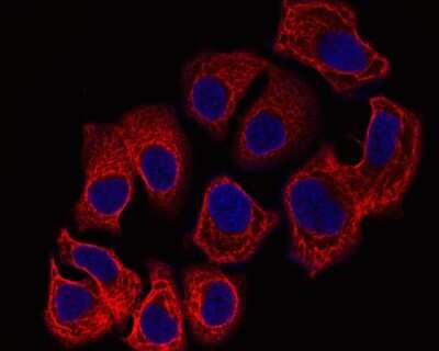 Immunocytochemistry/ Immunofluorescence: Cytokeratin 7/13/17/18 Antibody (ST50-05) [NBP2-67533]