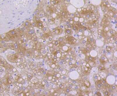 Immunohistochemistry-Paraffin: Cytokeratin 7/13/17/18 Antibody (ST50-05) [NBP2-67533]